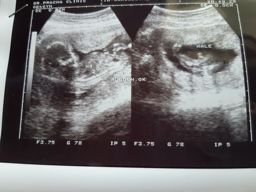 ตั้งชื่อเล่นลูกชาย