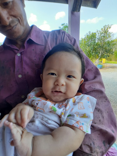 ทางบ้านสามีหอมแก้มลูกจนผื่นขึ้นเต็ม