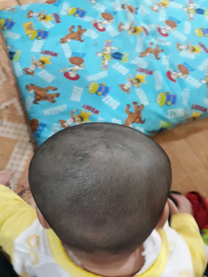 bentuk kepala anak saya