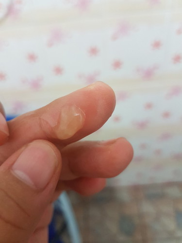 มูกหรือป่าว