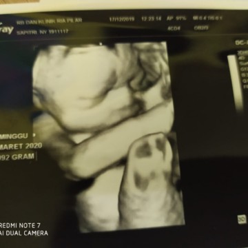 27mnggu