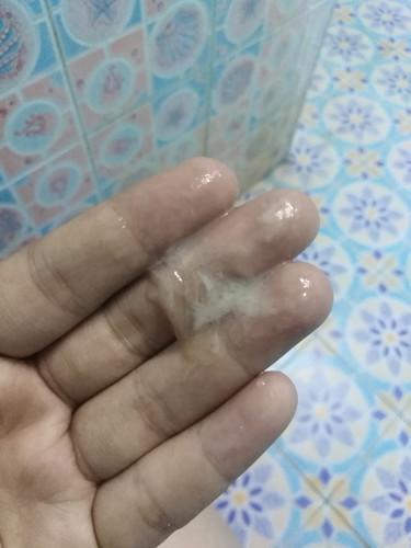 แม่ๆคะท้อง7เดือนมีมูกใสออกมากับตกขาวแบบนี้เป็นอันตรายไหมคะ