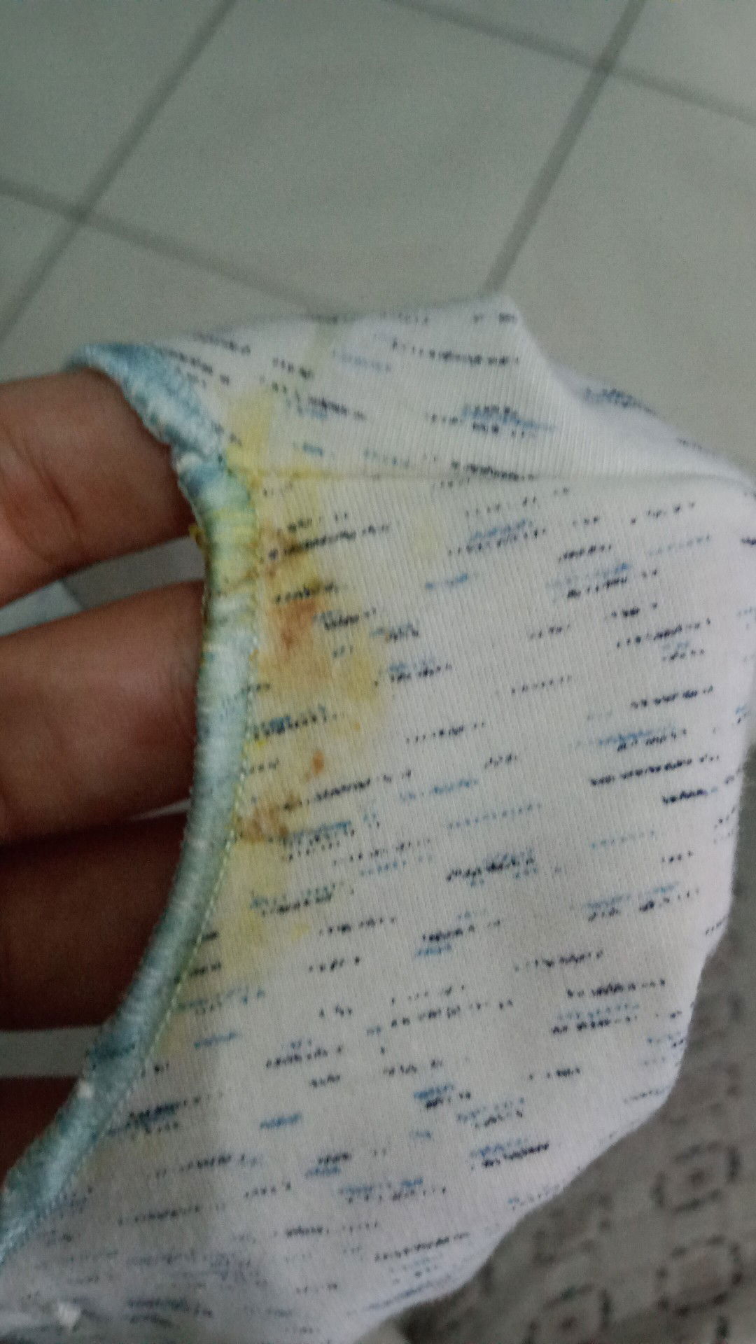 Noda Kuning Di Baju Bayi