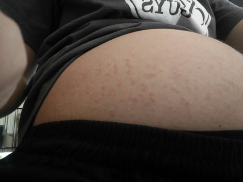 แม่ท้อง 23 week
