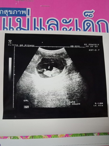 ตอน2เดือนครึ่งแม่ๆคนไหนเห็นกันยังคะปุ่มแขนปุ่มขาค่ะ