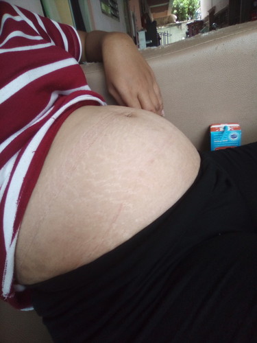 ท้อง26วีกท้องเล็กไปไหมค่ะท้อง3