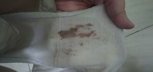 hamil 5 minggu ada flek coklat