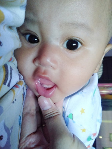 Tumbuh gigi
