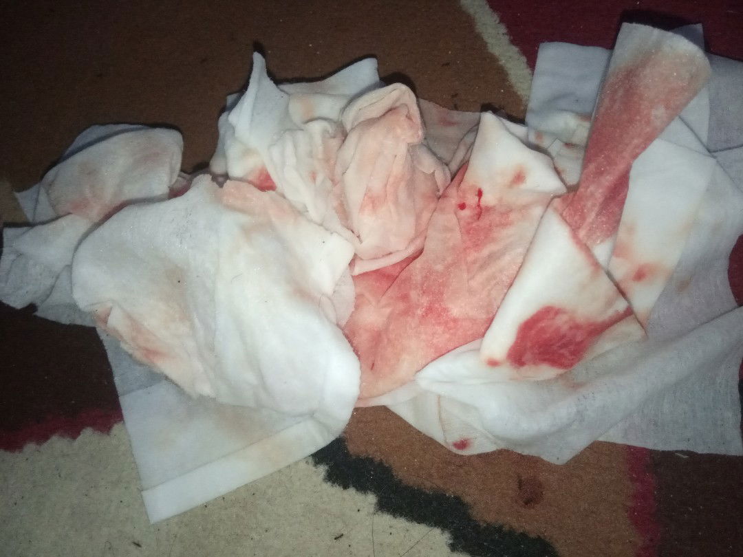 Pendarahan terus menerus