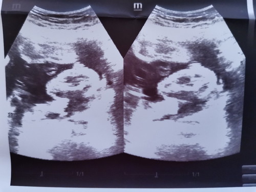 Help Po.. 25 Weeks And 5 Days Preggy..