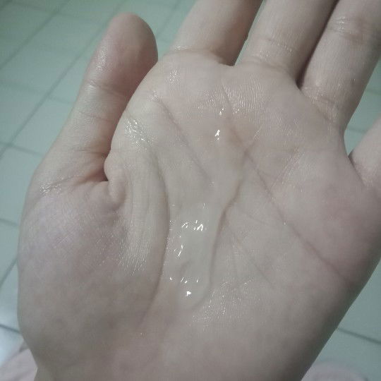 แบบนี้คือมูกใสตอนใกล้คลอดหรือเปล่าคะ