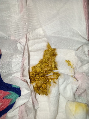 Nestogen Low Lactose