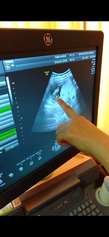 tebak2an buah manggis