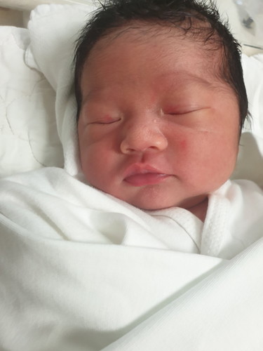 คลอดน้องแล้วมีอาการท้องอืดคล้ายๆกรดไหลย้อนทำไงให้หายคะ เปนมาได้2วันแล้ว ท้องแรกคลอดน้องตอน 39+4 w