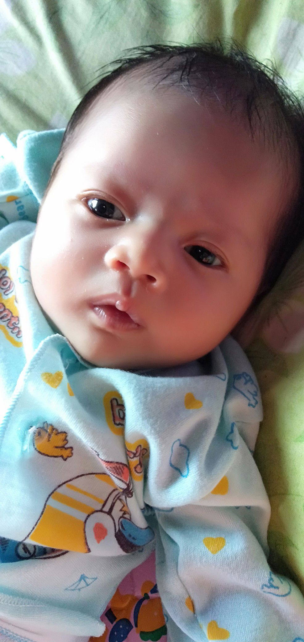 puting susu luka/lecett