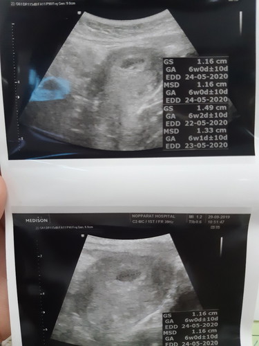 กังวลมากๆค่ะ