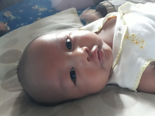 bayi sering "ngeden dan molet"