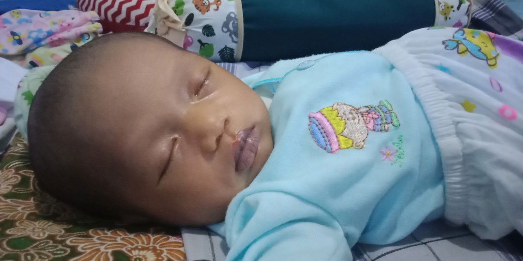 bibir bayi biru kehitaman