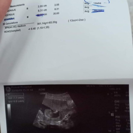 ซาว 14วีคเห็นเป็นรูปร่างหรือยัง