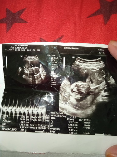 USG 4 bulan kmrin