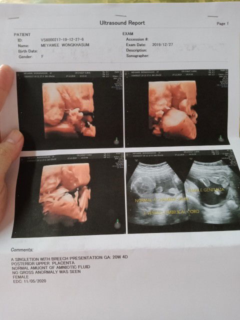 เเม่ๆคนไหนกำหนดคลอด พฤษภาคม บ้าง