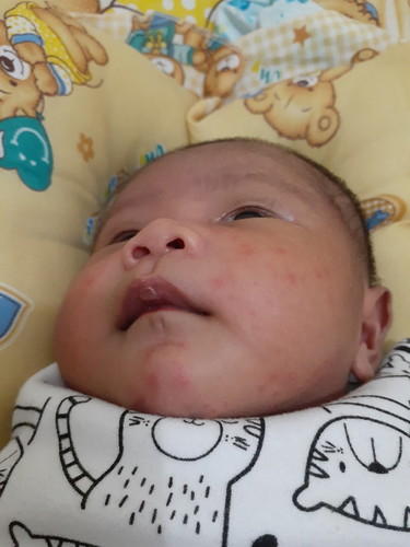 Merah di pipi