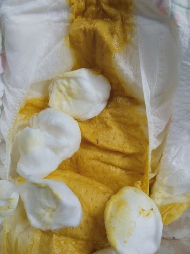 อยากปรึกษาแม่ๆเรื่องสีถ่าย ด่วนๆๆๆคะ