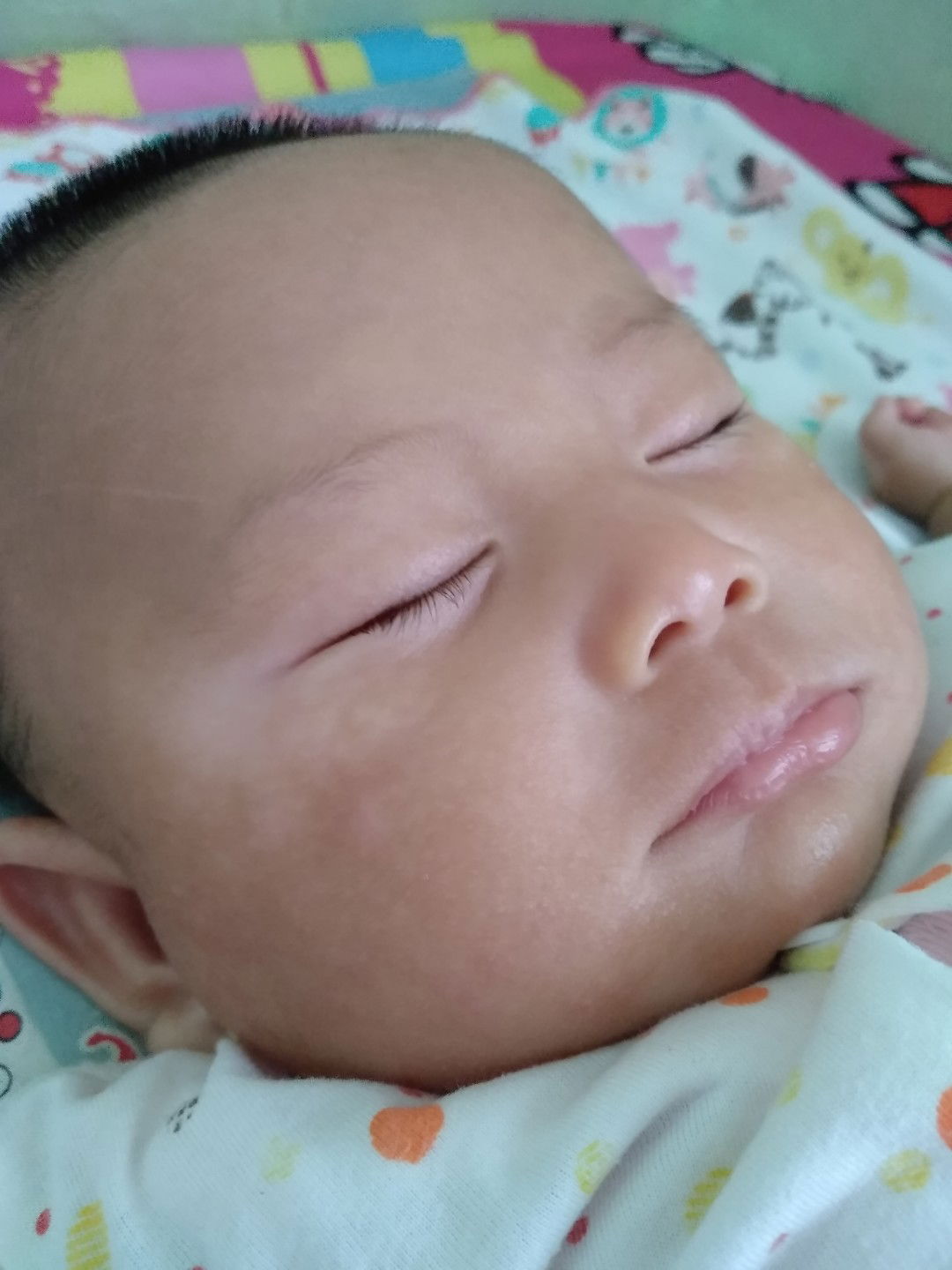 putih putih pada muka bayi
