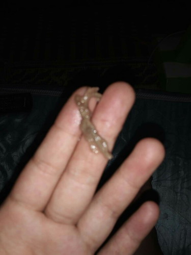 ออกมาจากช่องคลอด