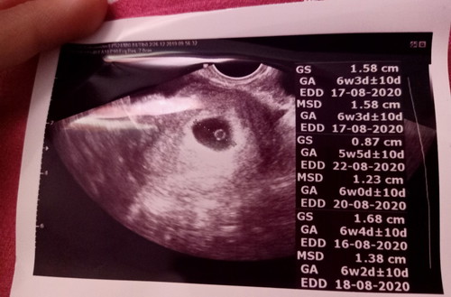 ปกติหรือป่าวคะ