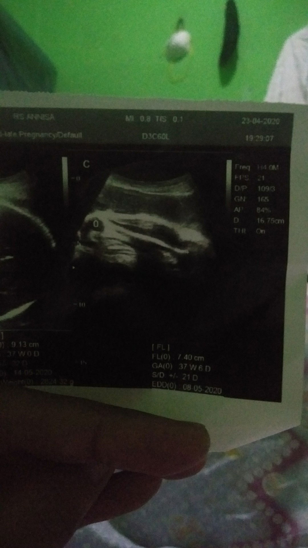 semoga jangan disuruh SC