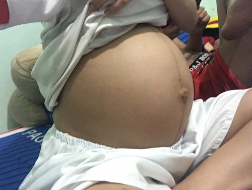 6เดือนแล้วท้องเล็กมั้ยคะแบบนี้