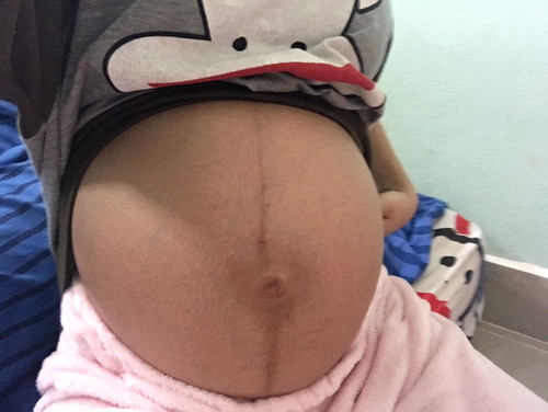7เดือนแล้วมีคนทักว่าท้องเล็ก