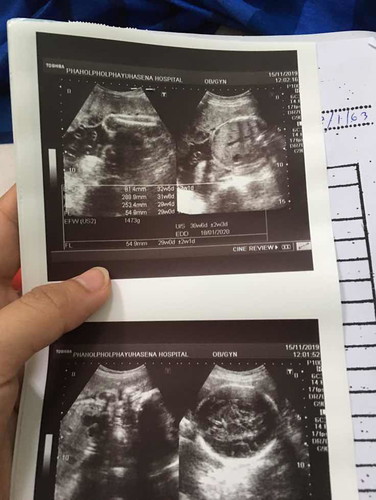 7เดือน ซาวมาหนัก1473 g