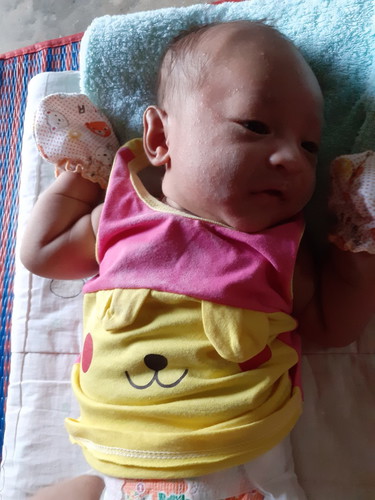 ใบหน้ามีผื่น