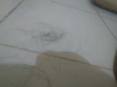kenapa nya kalau aku skt kepala trs rambut aku rontok semua ibu