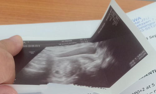 Unable to read Gestation