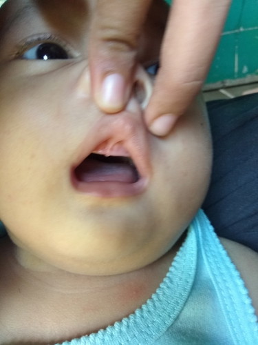 kesehatan bayi