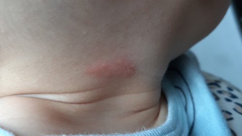 Does anyone know what these bumps are?