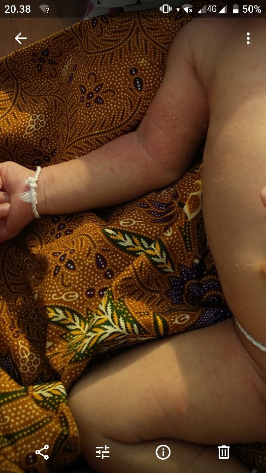 bayi wajar gak sih????