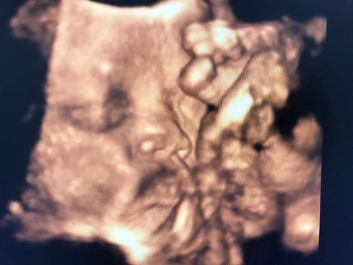 34วีค2วัน