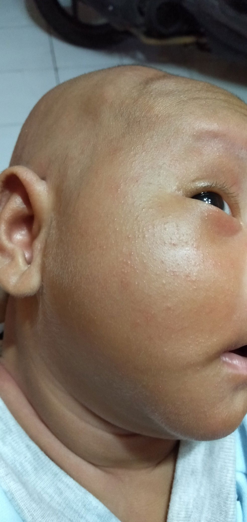 wajah merintis pada bayi