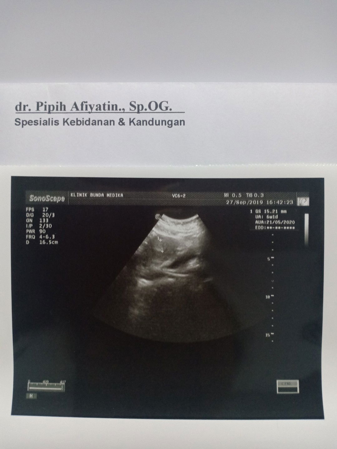 Cek dokter kandungan USG pertama