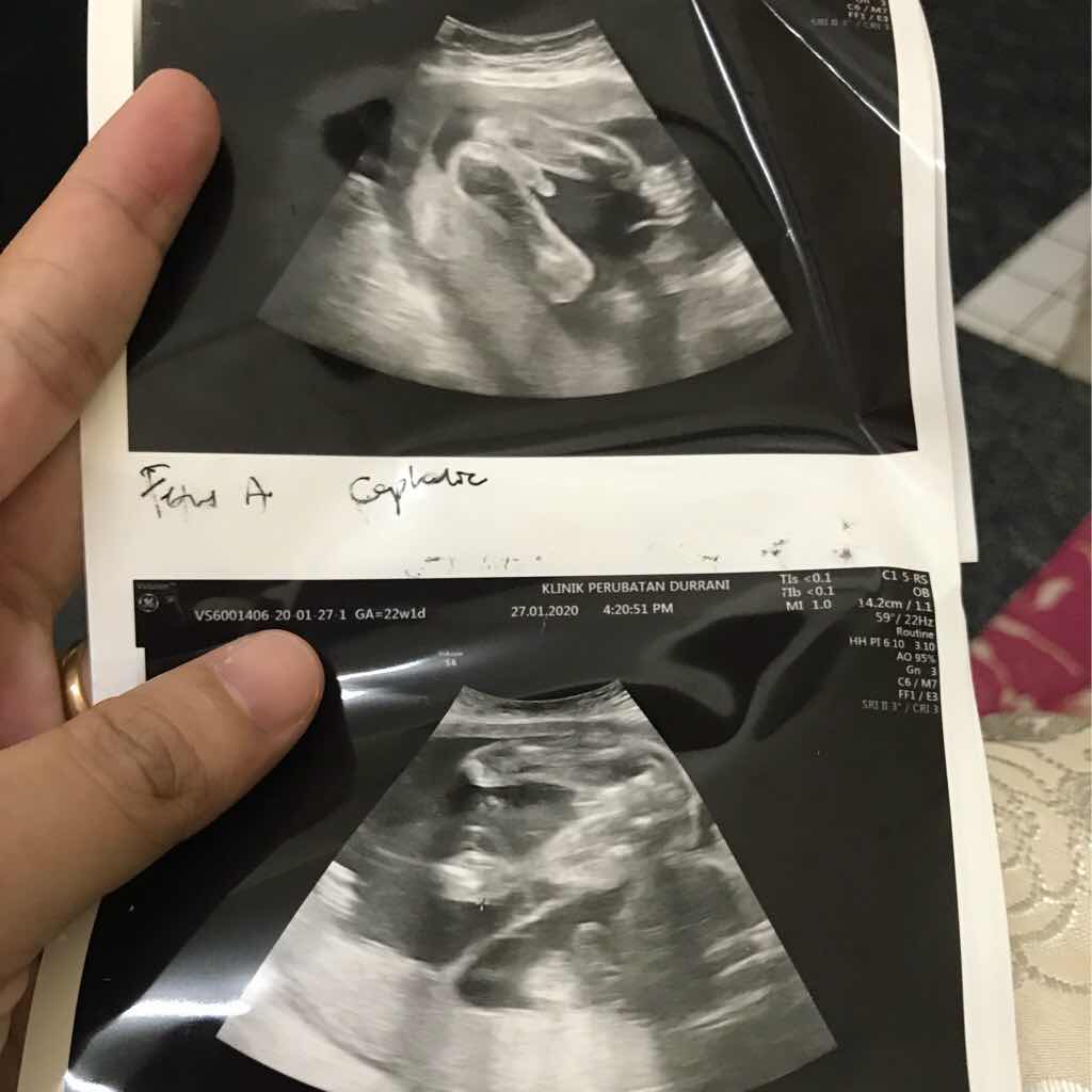 SITI MUNIRAH profile icon