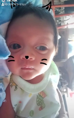 ความเจ็บปวดที่งดงาม