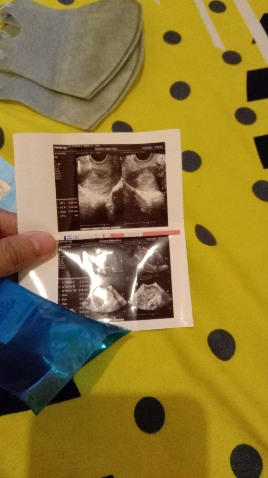 Lina Anggraini Siregar profile icon