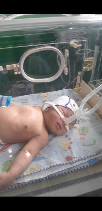 pernafasan bayi yg cepat