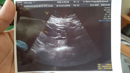 12 week