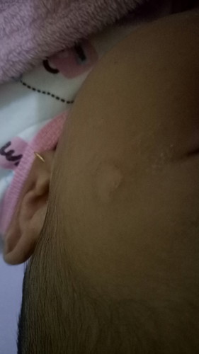 kulit wajah mengering