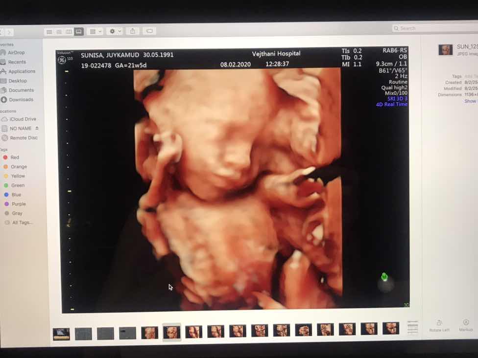 ชอบมองรูปอัลตร้าซาวด์ :))